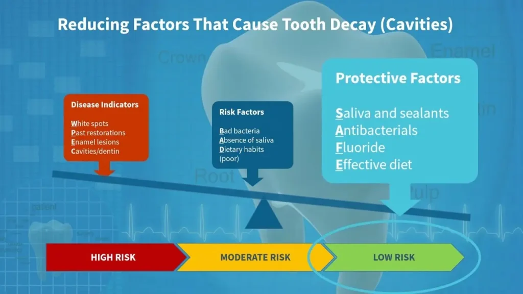 Factors Affecting Tooth Decay Risk