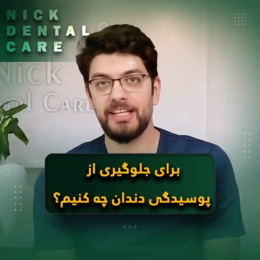 جلوگیری از پوسیدگی دندان