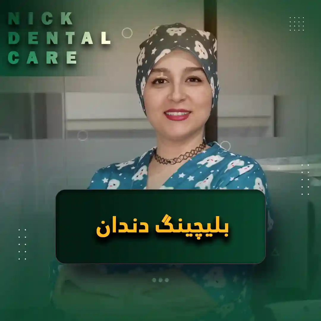 بلیچینگ دندان