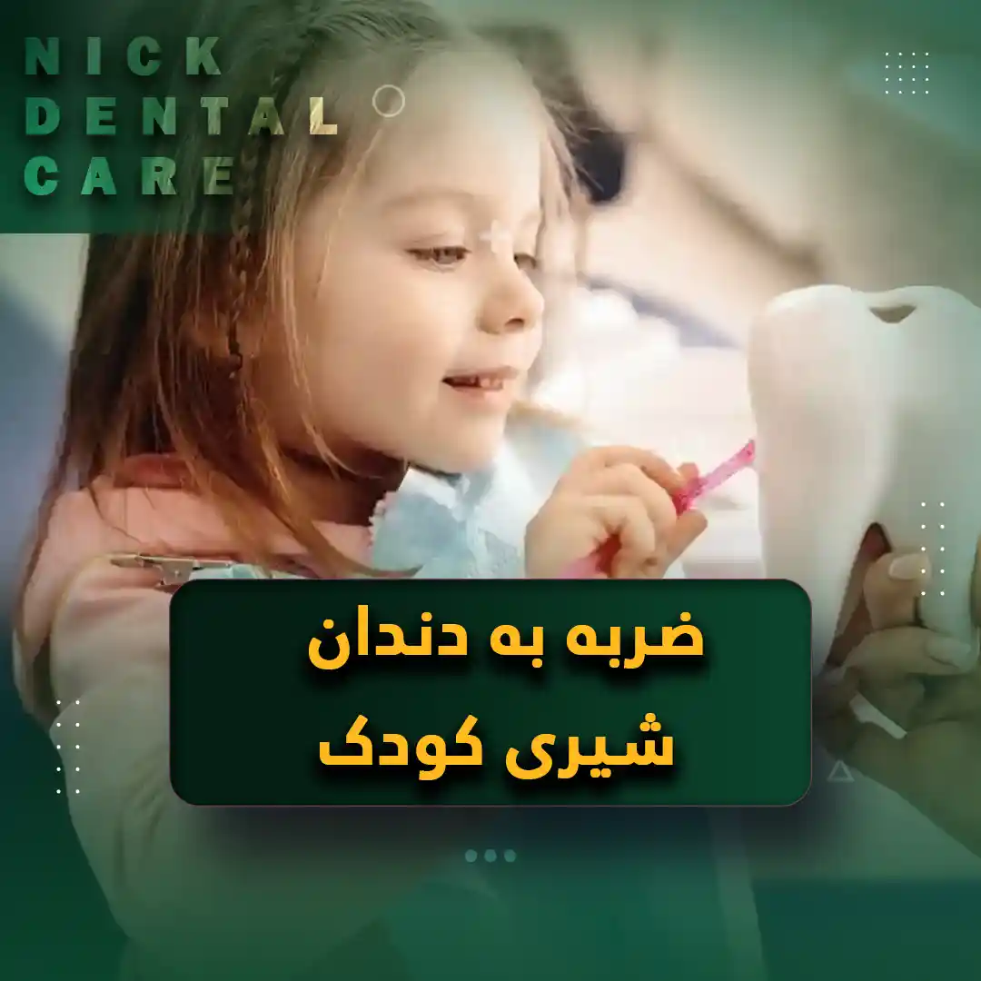 ضربه به دندان شیری کودک