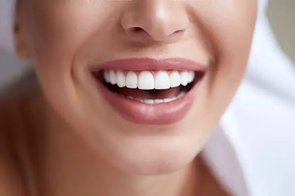 لمینت دندان- مطب نیک سعادت آباد